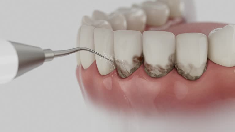 Trusted Teeth Whitening service in McKinney, TX - Dentist Open Now